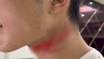 男主播骑车载女友回家被路边掉落网线勒伤脖子，索赔3万陷僵局 律师解读该谁赔